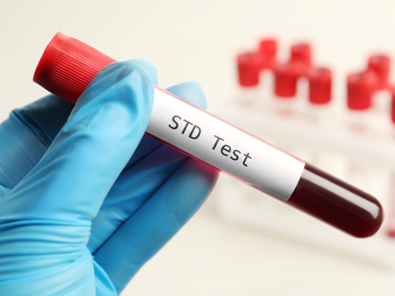 STD Testing 