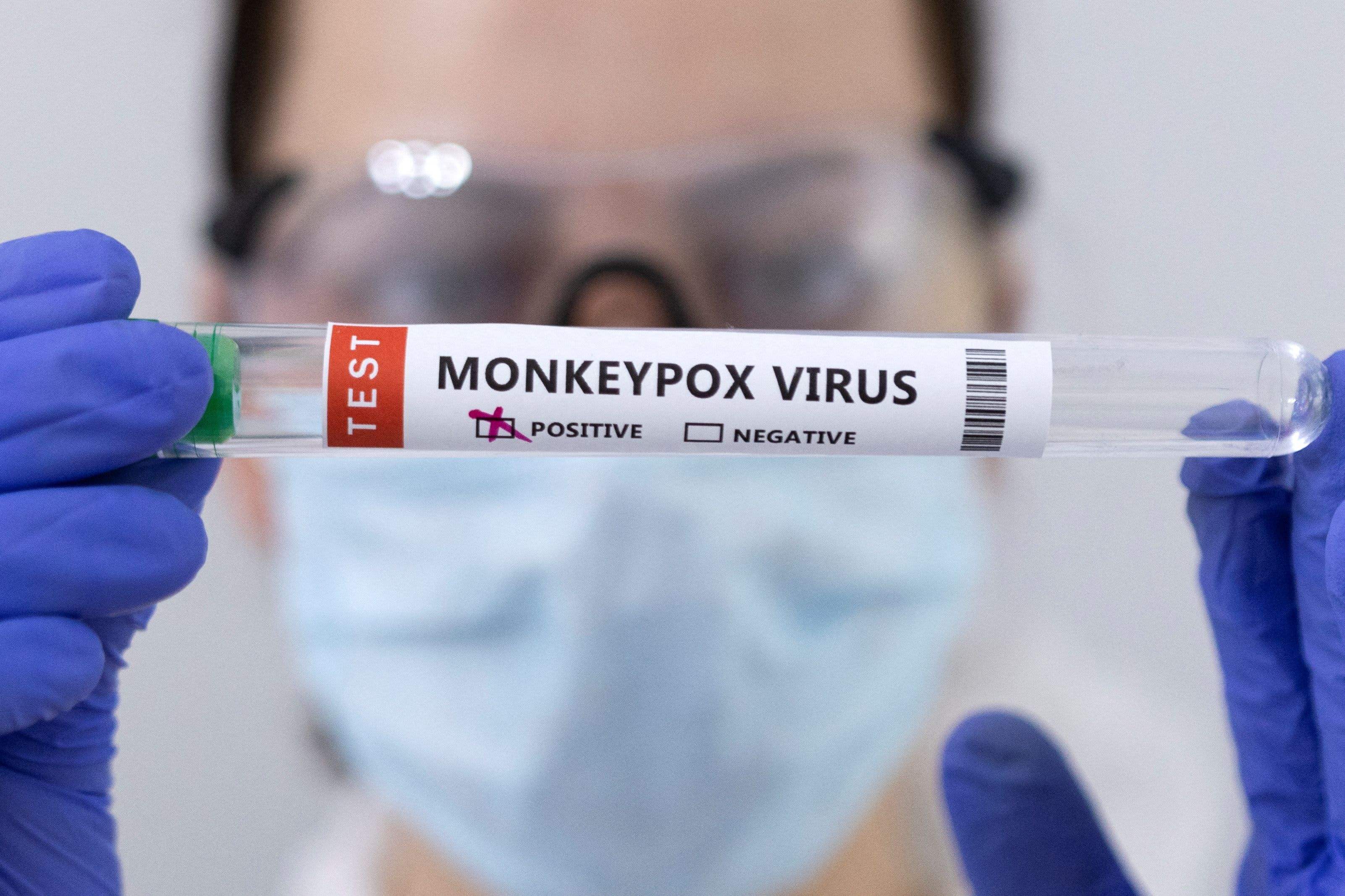 Monkeypox Testing
